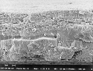 Photomicrograph of nacre layers